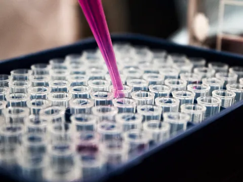 EIT Health - Pipette und Reagenzgläser